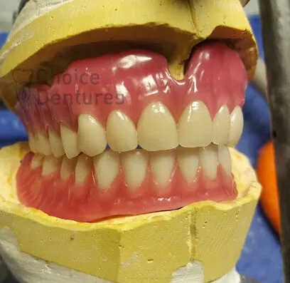 Choice Dentures header